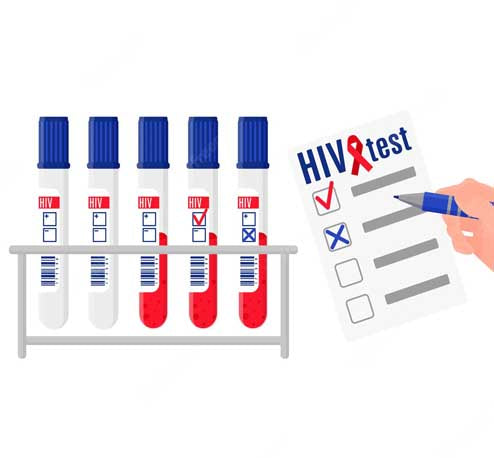 Understanding of HIV Test Results